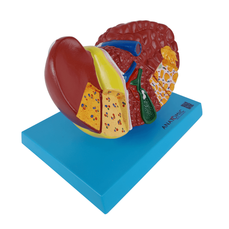 Figado-com-Patologia-Center-Medical