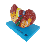 Figado-com-Patologia-Center-Medical