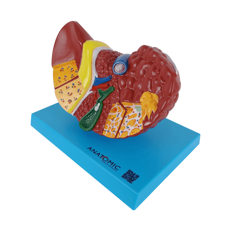 Figado-com-Patologia-Center-Medical