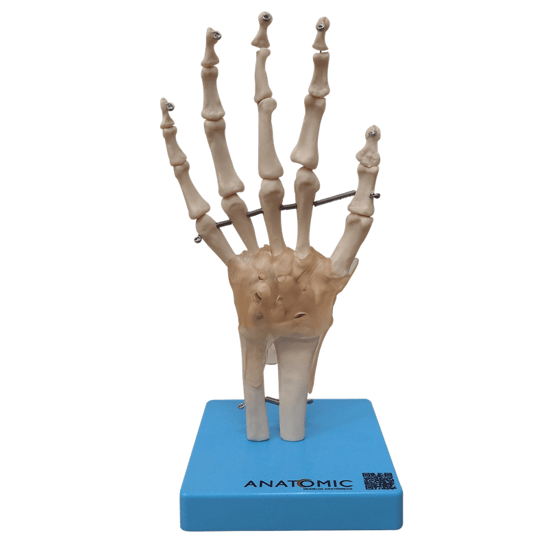 Articulacao-da-Mao-Center-Medical