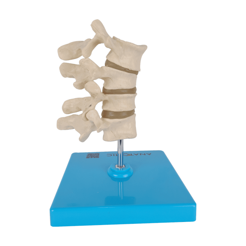 Osteoporose-4-Vertebras-Center-Medical